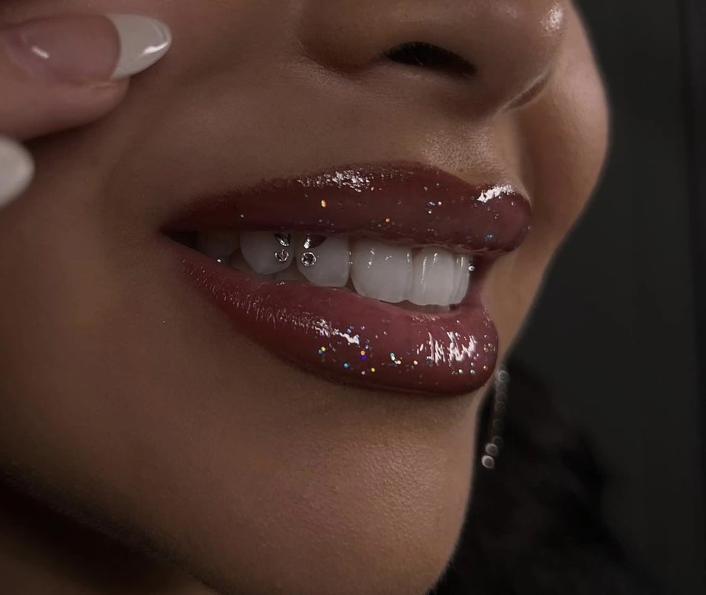 Tandkristal (tooth gem) — subtiel sprankelend accent